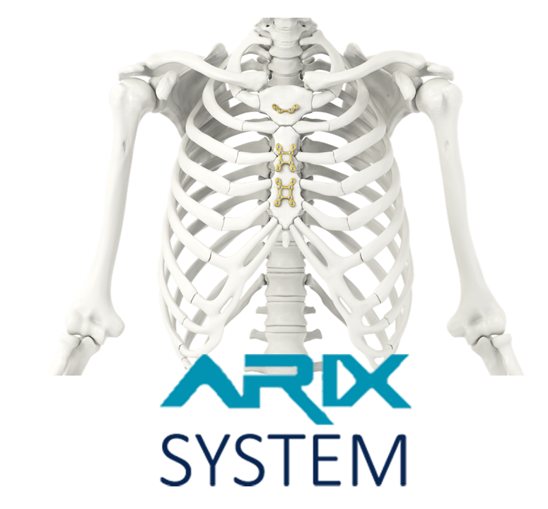 Arix System